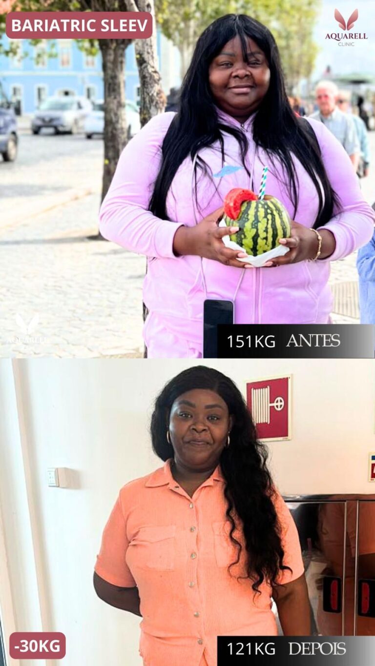 Weight Loss -1