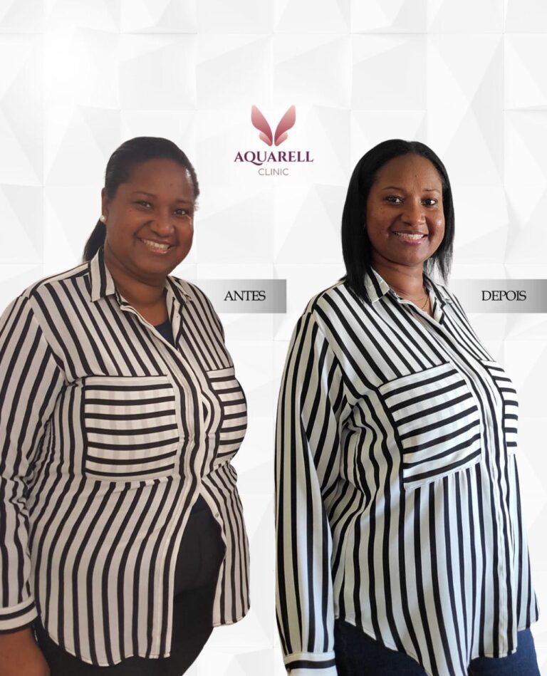 Weight Loss -2